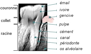 chirurgien dentiste bordeaux anatomie de la dent